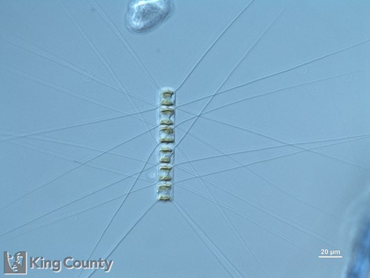 Photo of Chaetoceros similis